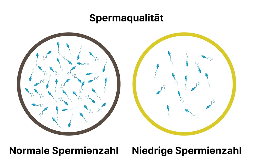Spermaqualität: Normale vs. niedrige Spermienzahl