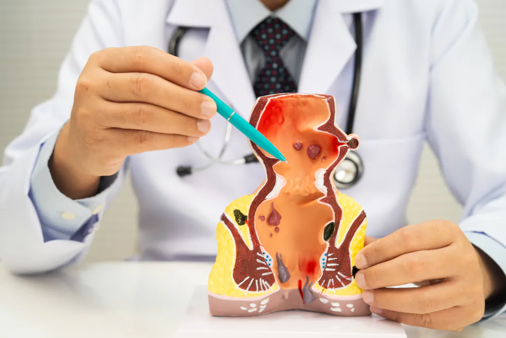 Arzt erkl&auml;rt H&auml;morrhoiden-Behandlung