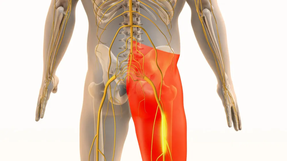 Anatomie des Ischiasnerven