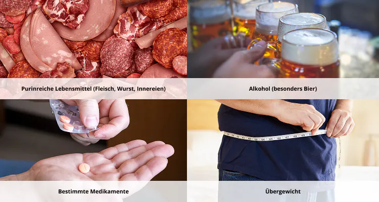 Ausl&ouml;ser: Purinreiche Lebensmittel, Alkohol, Medikamente, &Uuml;bergewicht
