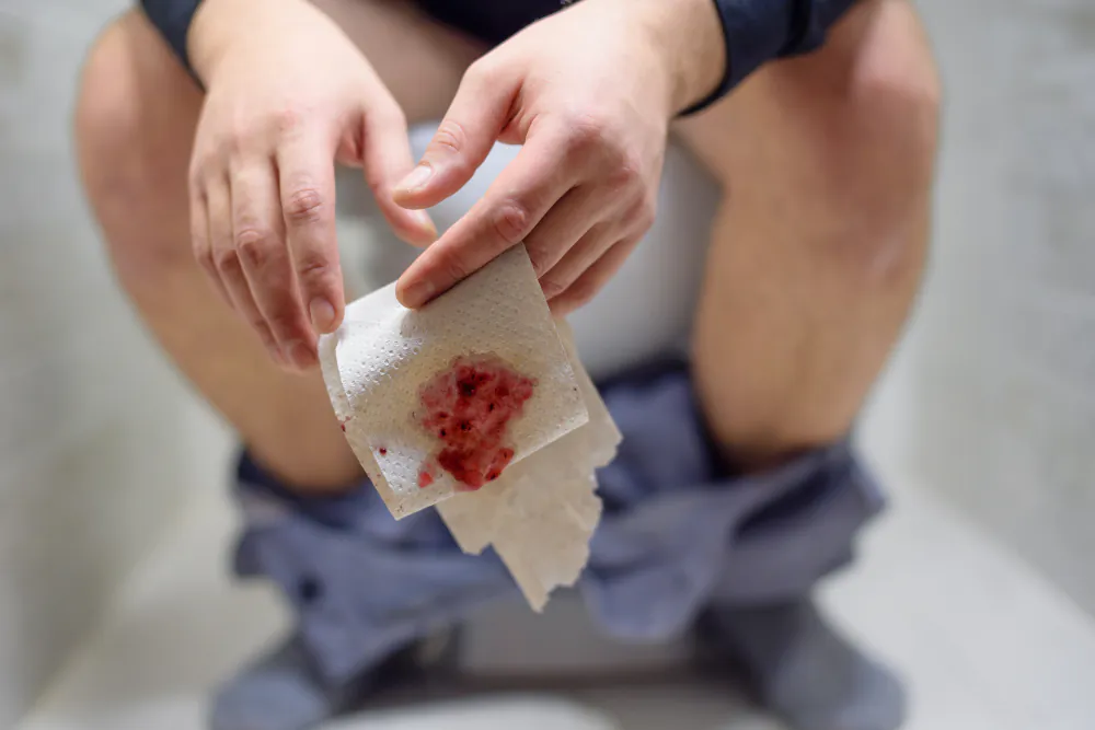 Blut im Stuhl Ursachen