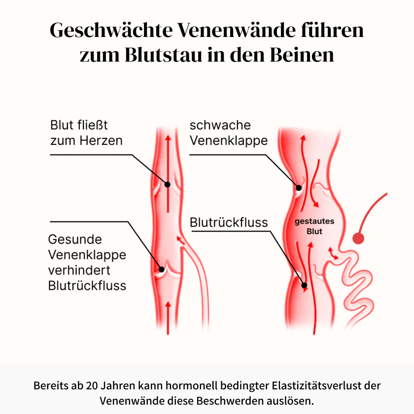 Beine natürlich unterstützen